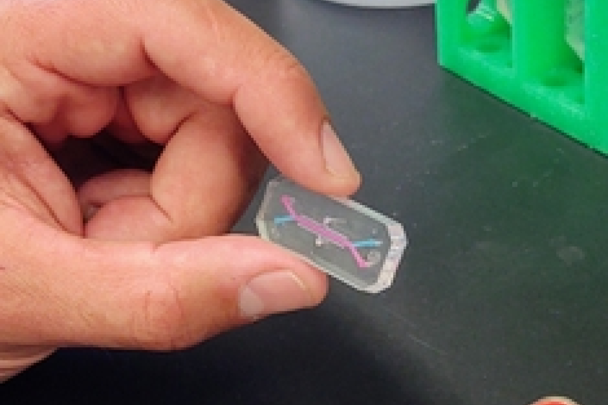 hand holding bone marrow chip device